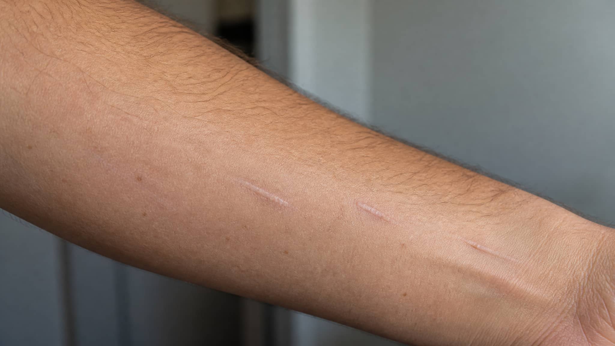 distinguishing track marks meaning